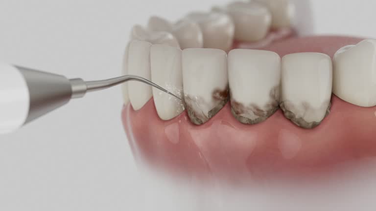 Reliable Dental contractor in Waretown, NJ by Smile Center Dentistry